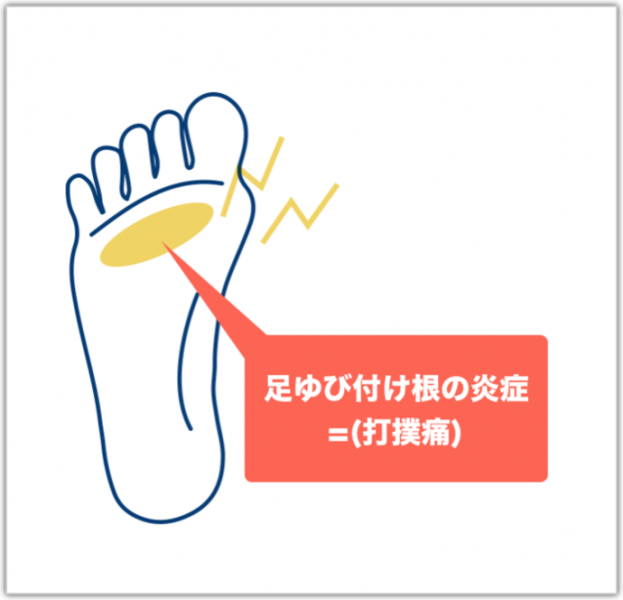 足指の付け根の炎症